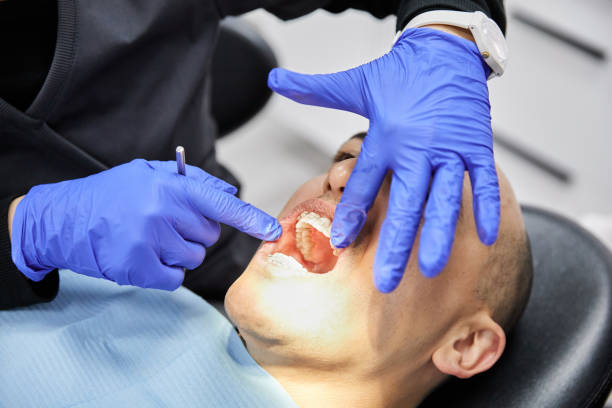 Best Emergency Dentist for Knocked-Out Tooth in North Charleston, SC