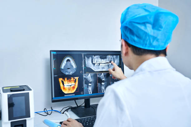 Best Emergency Dentist for Lost Fillings or Crowns in North Charleston, SC